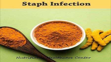 Staphylococcus Treatment: Effective Supplements & Remedies in Accra, Ghana