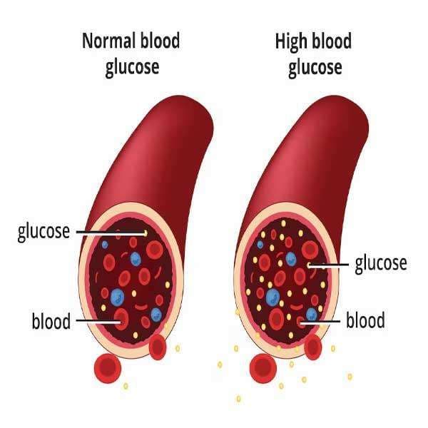 High Blood Sugar Treatment: Effective Supplements to Lower Blood Sugar Naturally in Accra, Ghana