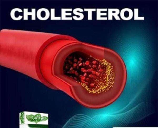 High Cholesterol Treatment: Effective Medicine & Remedies in Accra, Ghana